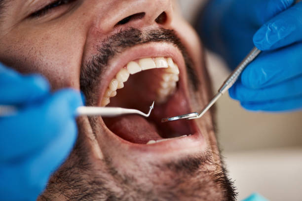 Best Emergency Tooth Extraction in Knob Noster, MO